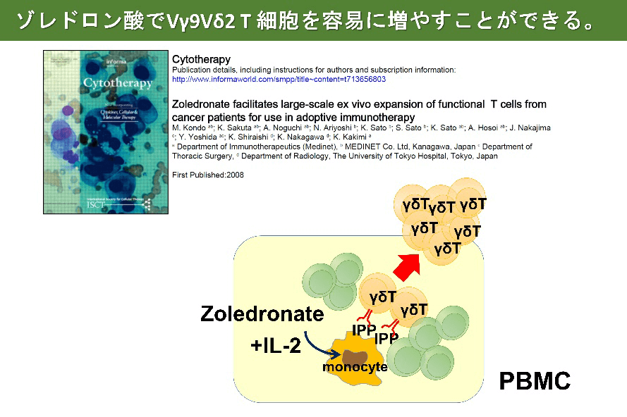ゾレドロン酸でVγ9Vδ2T細胞を容易に増やすことができる。