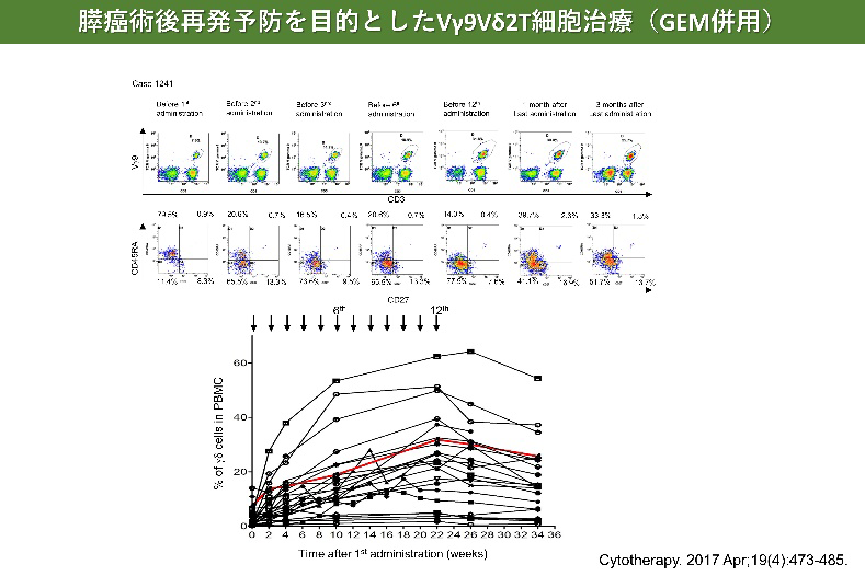 膵癌術後再発予防を目的としたVγ9Vδ2T細胞治療（GEM併用）