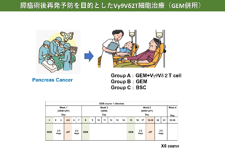 膵癌術後再発予防を目的としたVγ9Vδ2T細胞治療（GEM併用）